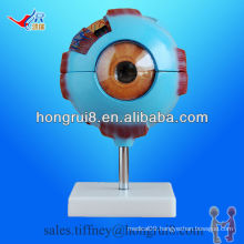 ISO Detachable Eye Anatomy model, Amplified Eyeball Model
